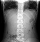 临床医师实践技能第三站要点：腹部X线影像的诊断
